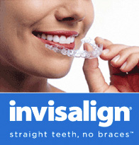 Invisalign (invisible braces)