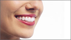 Invisible braces