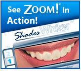 Zoom teeth whitening